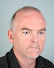 Before Hair Transplant&nbsp;2 Sessions (Areas)